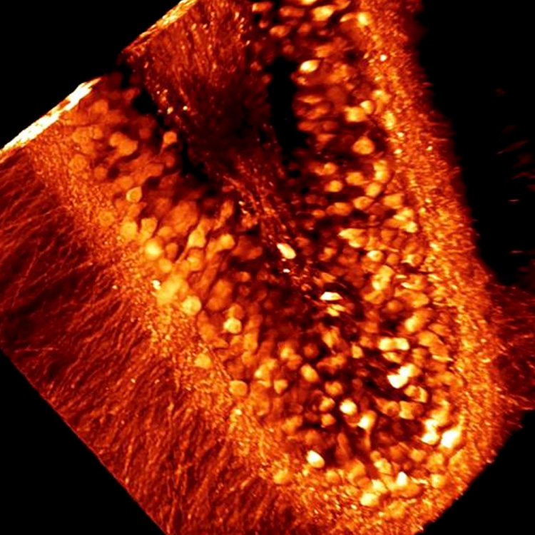 Ablación ultrarrápida de tejido